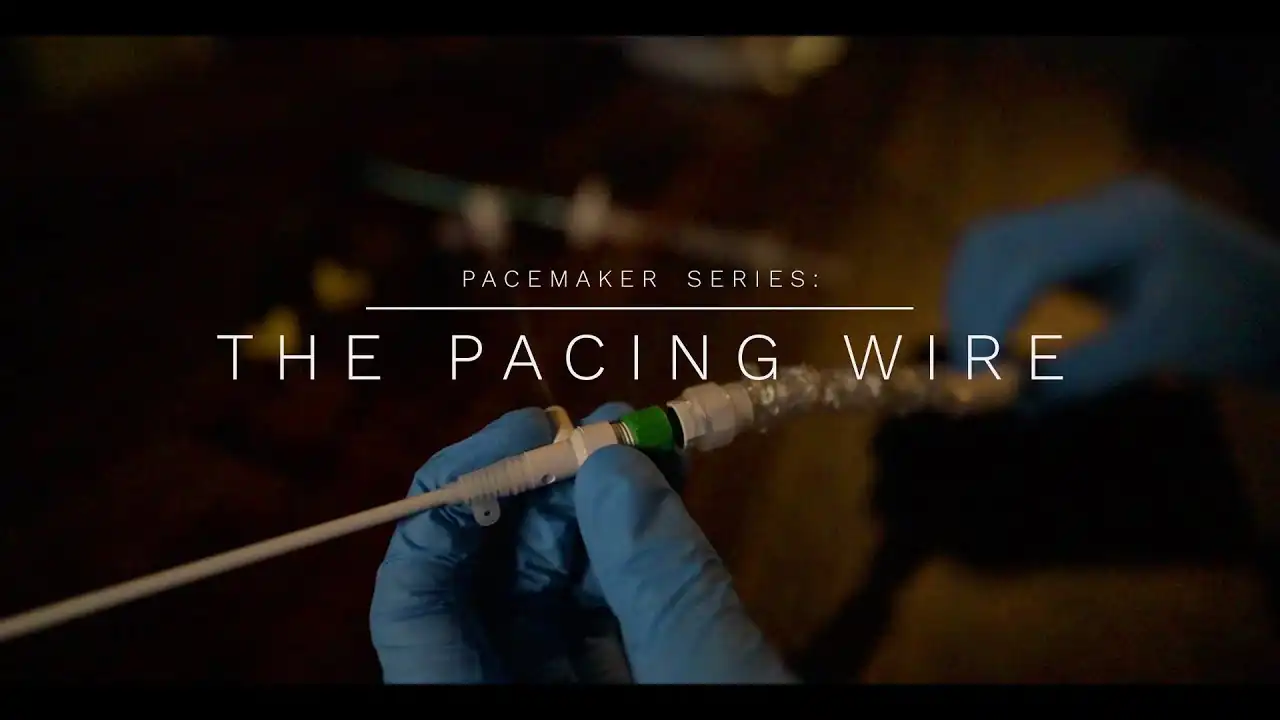 pacing wire thumbnail
